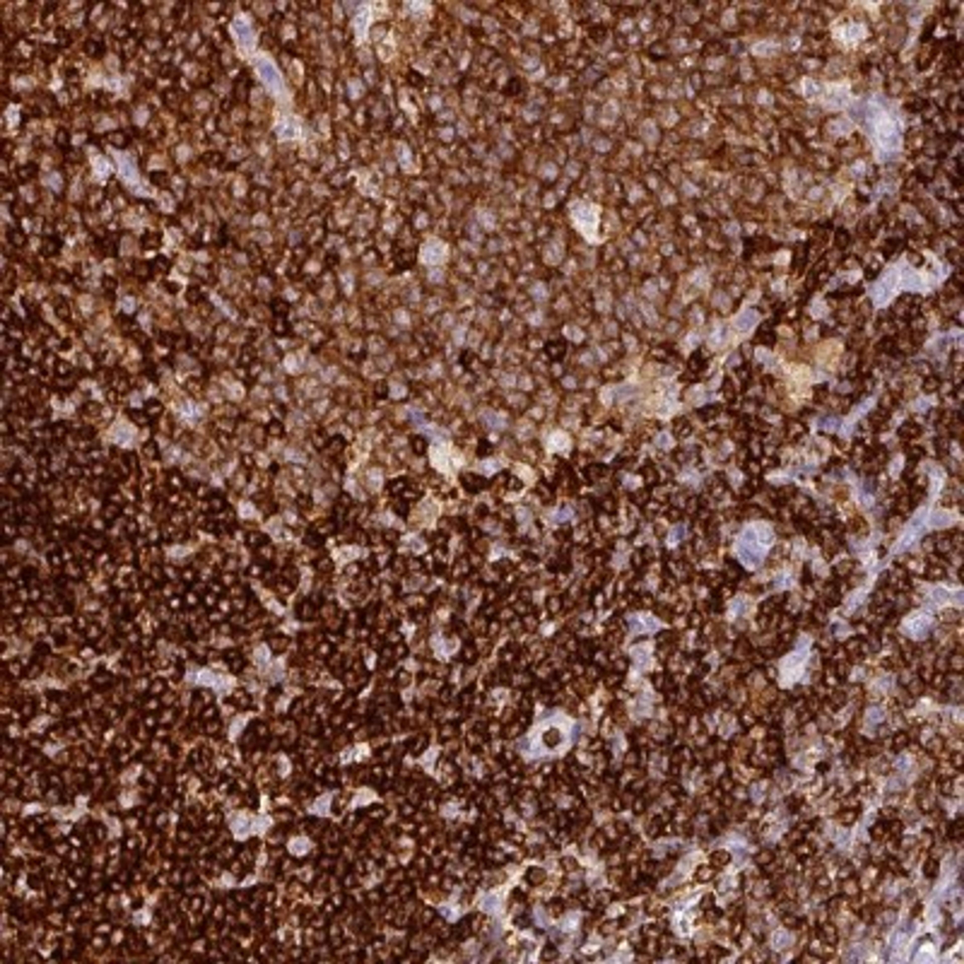 Immunohistochemistry: Enah/Vasp-like Antibody [NBP2-38132] - Staining of human tonsil shows strong cytoplasmic positivity in germinal and non germinal center cells.