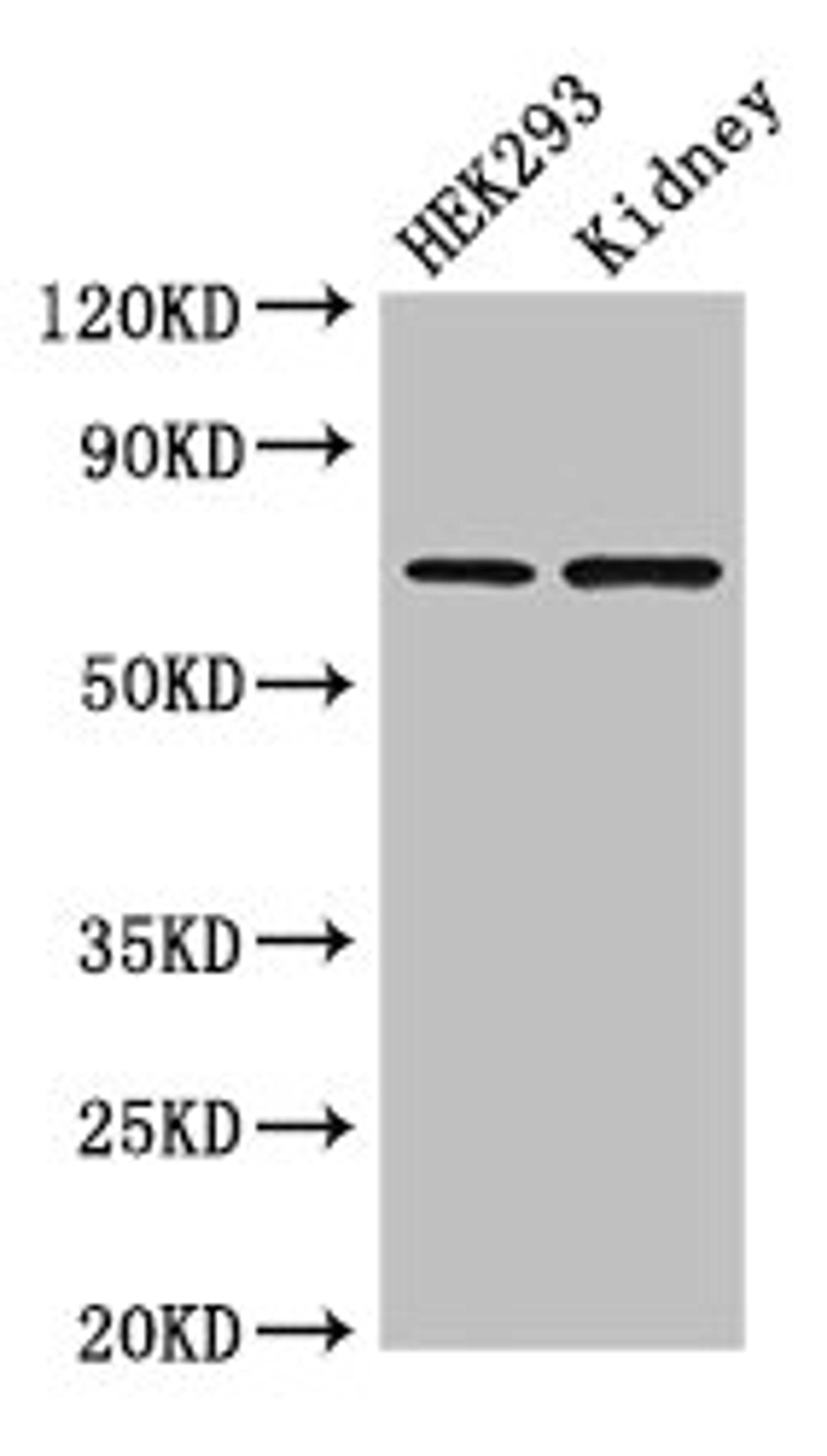 Western Blot. Positive WB detected in: HEK293 whole cell lysate, Mouse kidney tissue. All lanes: RABGGTA antibody at 1.5µg/ml. Secondary. Goat polyclonal to rabbit IgG at 1/50000 dilution. Predicted band size: 66 kDa. Observed band size: 66 kDa