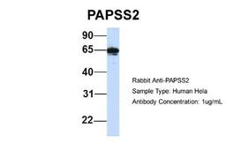 Western Blot: PAPSS2 Antibody [NBP1-55135] - Human Hela, Antibody Dilution: 1.0 ug/ml PAPSS2 is strongly supported by BioGPS gene expression data to be expressed in Human HeLa cells.