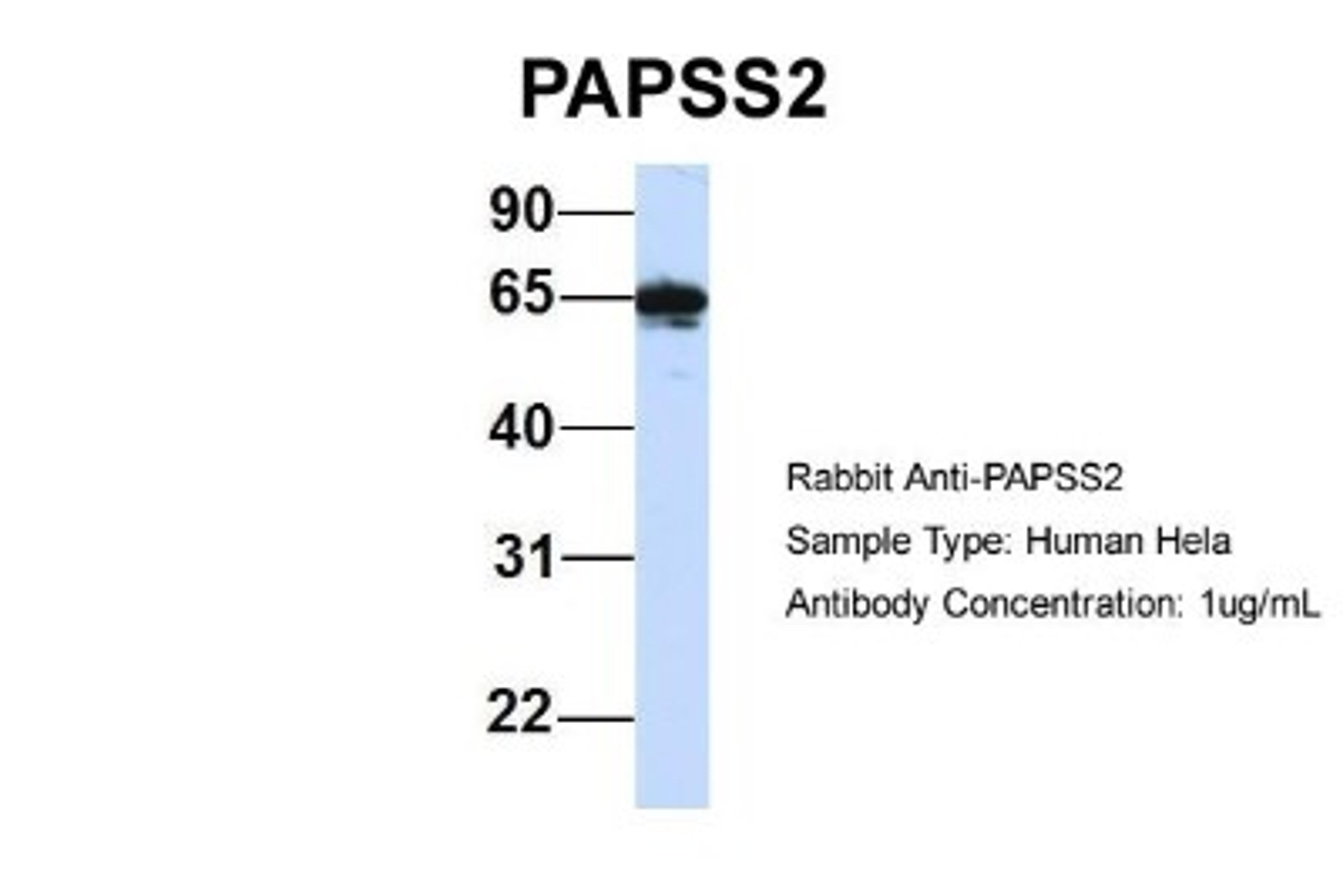 Western Blot: PAPSS2 Antibody [NBP1-55135] - Human Hela, Antibody Dilution: 1.0 ug/ml PAPSS2 is strongly supported by BioGPS gene expression data to be expressed in Human HeLa cells.