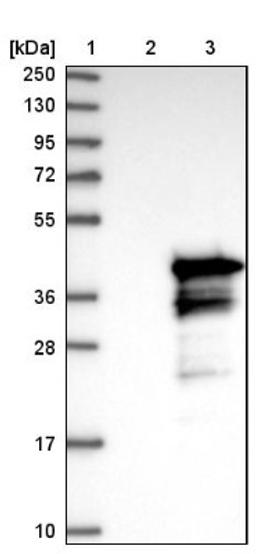 Western Blot: CCDC59 Antibody [NBP1-88368] - Lane 1: Marker [kDa] 250, 130, 95, 72, 55, 36, 28, 17, 10<br/>Lane 2: Negative control (vector only transfected HEK293T lysate)<br/>Lane 3: Over-expression lysate (Co-expressed with a C-terminal myc-DDK tag (~3.1 kDa) in mammalian HEK293T cells, LY415457)