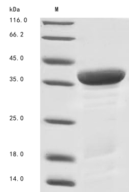 (Tris-Glycine gel) Discontinuous SDS-PAGE (reduced) with 5% enrichment gel and 15% separation gel.