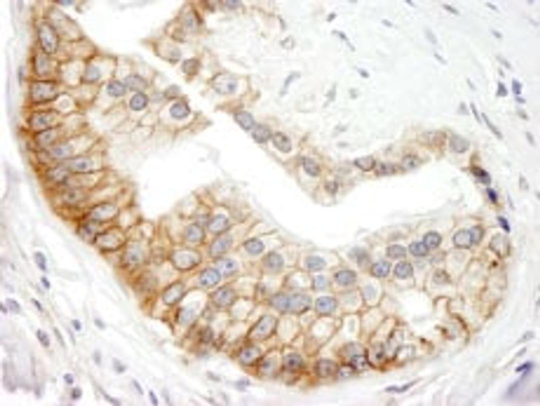 Detection of human ABCB9 by immunohistochemistry.