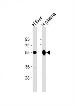 Western Blot at 1:2000 dilution Lane 1: human liver lysate Lane 2: human plasma lysate Lysates/proteins at 20 ug per lane.