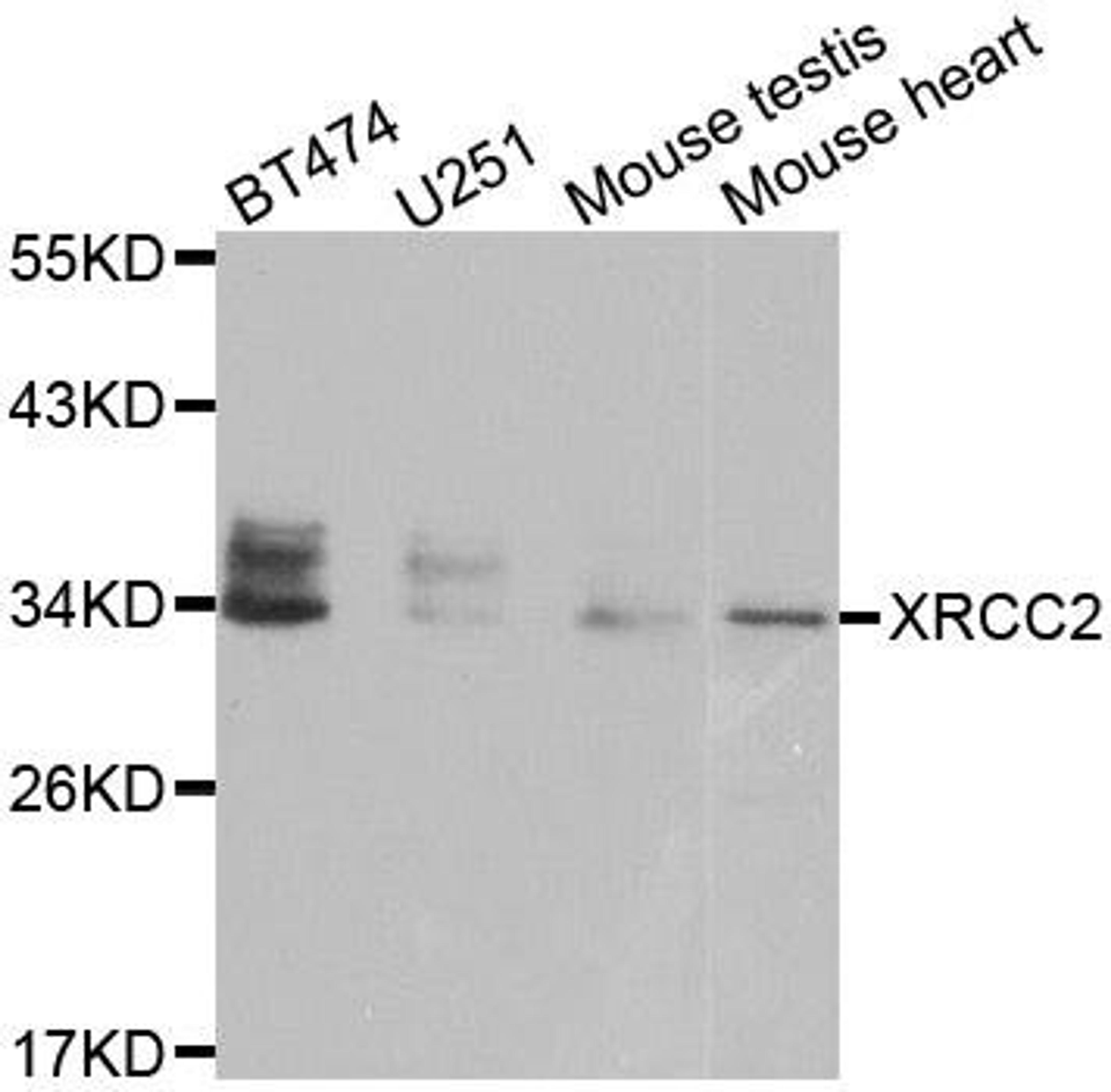 Western blot analysis of extracts of various cell lines using XRCC2 antibody