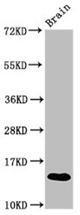 Western Blot. Positive WB detected in: Mouse brain tissue. All lanes: S100a9 antibody at 3.9µg/ml. Secondary. Goat polyclonal to rabbit IgG at 1/50000 dilution. Predicted band size: 14 kDa. Observed band size: 14 kDa