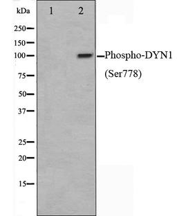 Western blot analysis of mouse brain cell lysate using DYN1 (Phospho-Ser778) antibody