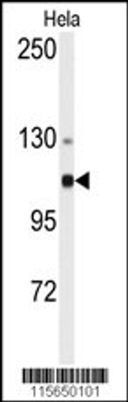 Western blot analysis of anti-ACTN4 Antibody in Hela cell line lysates (35ug/lane)