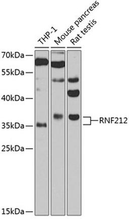 Western blot - RNF212 antibody (A3569)