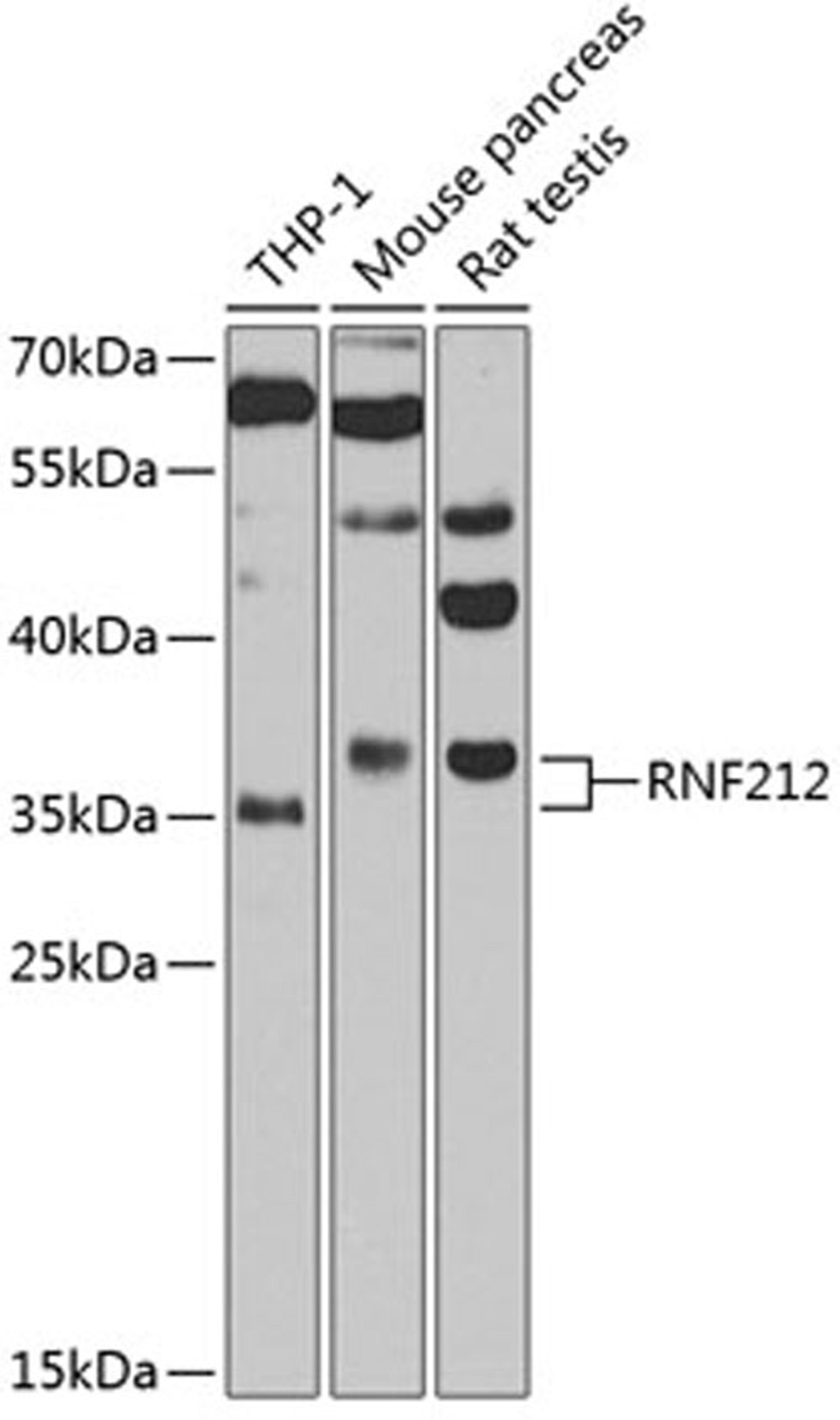 Western blot - RNF212 antibody (A3569)