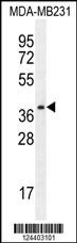 Western blot analysis in MDA-MB231 cell line lysates (35ug/lane).