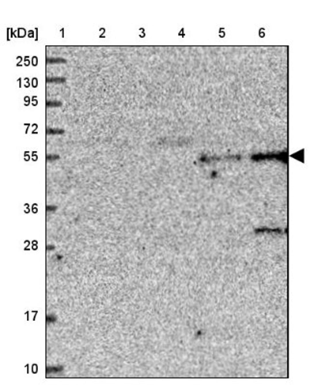 Western Blot: TMEM39B Antibody [NBP1-83868] - Lane 1: Marker [kDa] 250, 130, 95, 72, 55, 36, 28, 17, 10<br/>Lane 2: Human cell line RT-4<br/>Lane 3: Human cell line U-251MG sp<br/>Lane 4: Human plasma (IgG/HSA depleted)<br/>Lane 5: Human liver tissue<br/>Lane 6: Human tonsil tissue