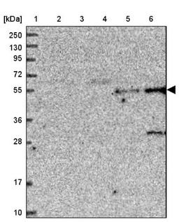 Western Blot: TMEM39B Antibody [NBP1-83868] - Lane 1: Marker [kDa] 250, 130, 95, 72, 55, 36, 28, 17, 10<br/>Lane 2: Human cell line RT-4<br/>Lane 3: Human cell line U-251MG sp<br/>Lane 4: Human plasma (IgG/HSA depleted)<br/>Lane 5: Human liver tissue<br/>Lane 6: Human tonsil tissue