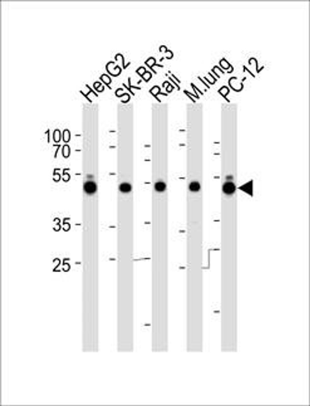 Western blot analysis of HepG2, SK-BR-3, Raji cell line mouse lung tissue lysate and rat PC-12 cell line (from left to right)using DNAJA1 antibody (primary antibody dilution at: 1:1000)