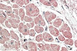 Immunohistochemistry-Paraffin: proANP Antibody [NBP1-97752] - Human Heart.