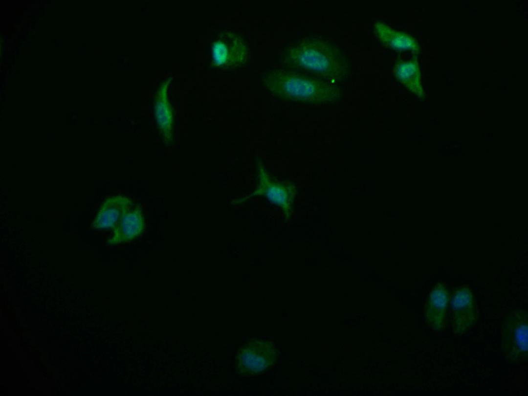 Immunofluorescence staining of HepG2 cell with CSB-RA178866A0HU at 1:50, counter-stained with DAPI. The cells were fixed in 4% formaldehyde and blocked in 10% normal Goat Serum. The cells were then incubated with the antibody overnight at 4°C. The secondary antibody was Alexa Fluor 569-congugated AffiniPure Goat Anti-Rabbit IgG(H+L).