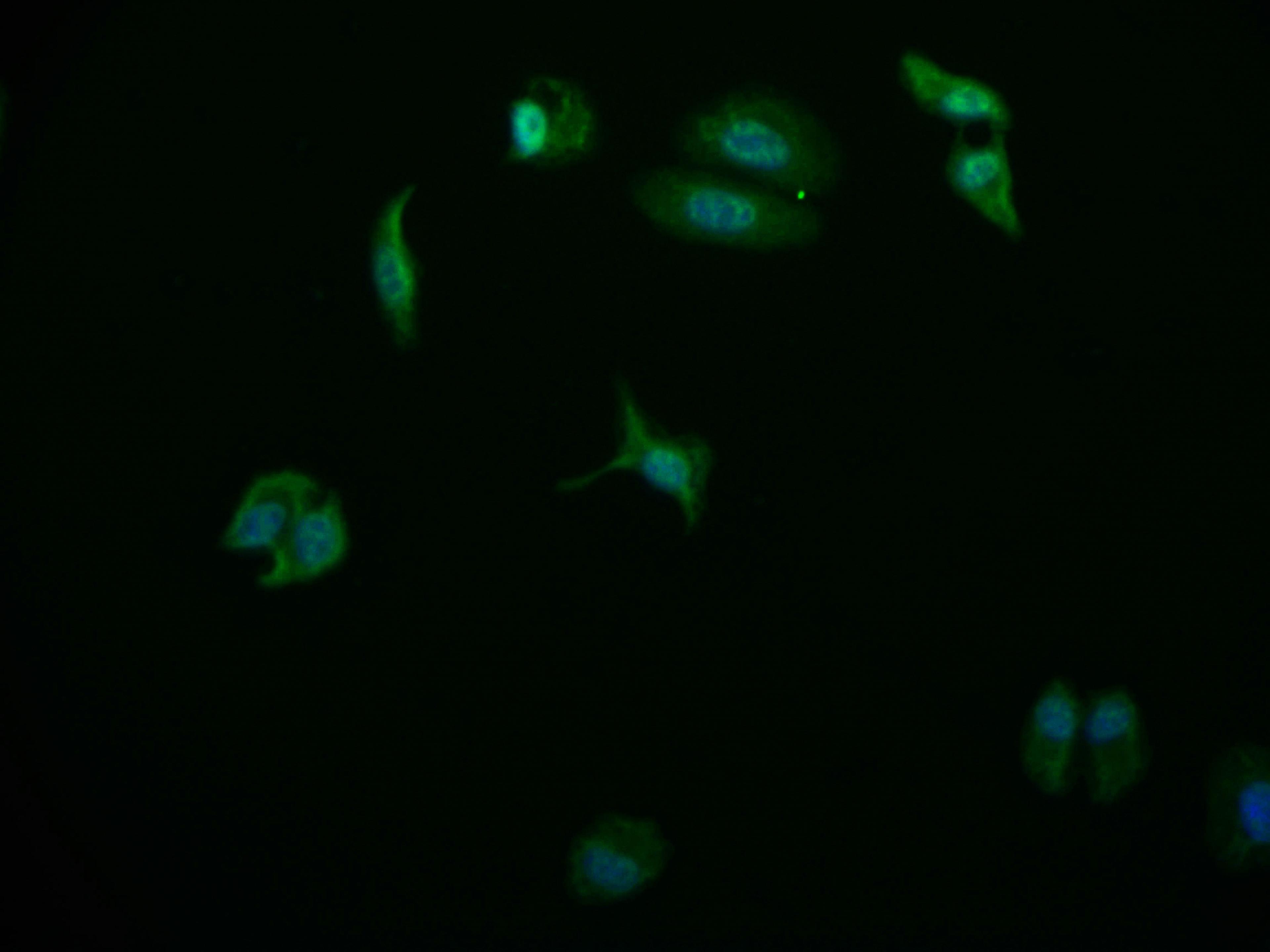 Immunofluorescence staining of HepG2 cell with CSB-RA178866A0HU at 1:50, counter-stained with DAPI. The cells were fixed in 4% formaldehyde and blocked in 10% normal Goat Serum. The cells were then incubated with the antibody overnight at 4°C. The secondary antibody was Alexa Fluor 569-congugated AffiniPure Goat Anti-Rabbit IgG(H+L).