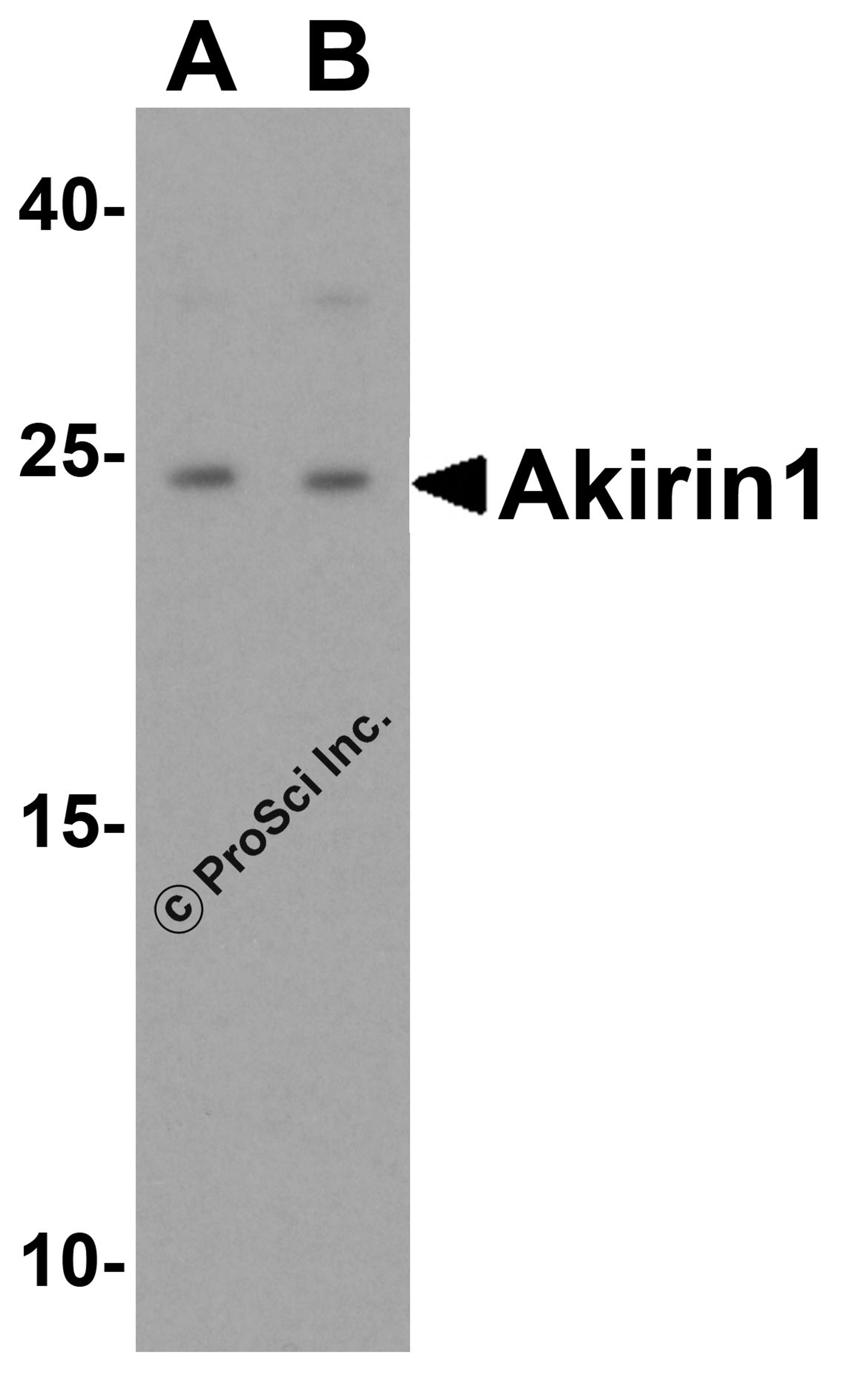 Western blot analysis of Akirin1 in rat liver tissue lysate with Akirin1 antibody at (A) 1 and (B) 2 μg/mL.