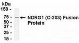 E coli-derived fusion protein as test antigen. Affinity-purified IgY dilution: 1:2000, Goat anti-IgY-HRP dilution: 1:1000. Colorimetric method for signal development.