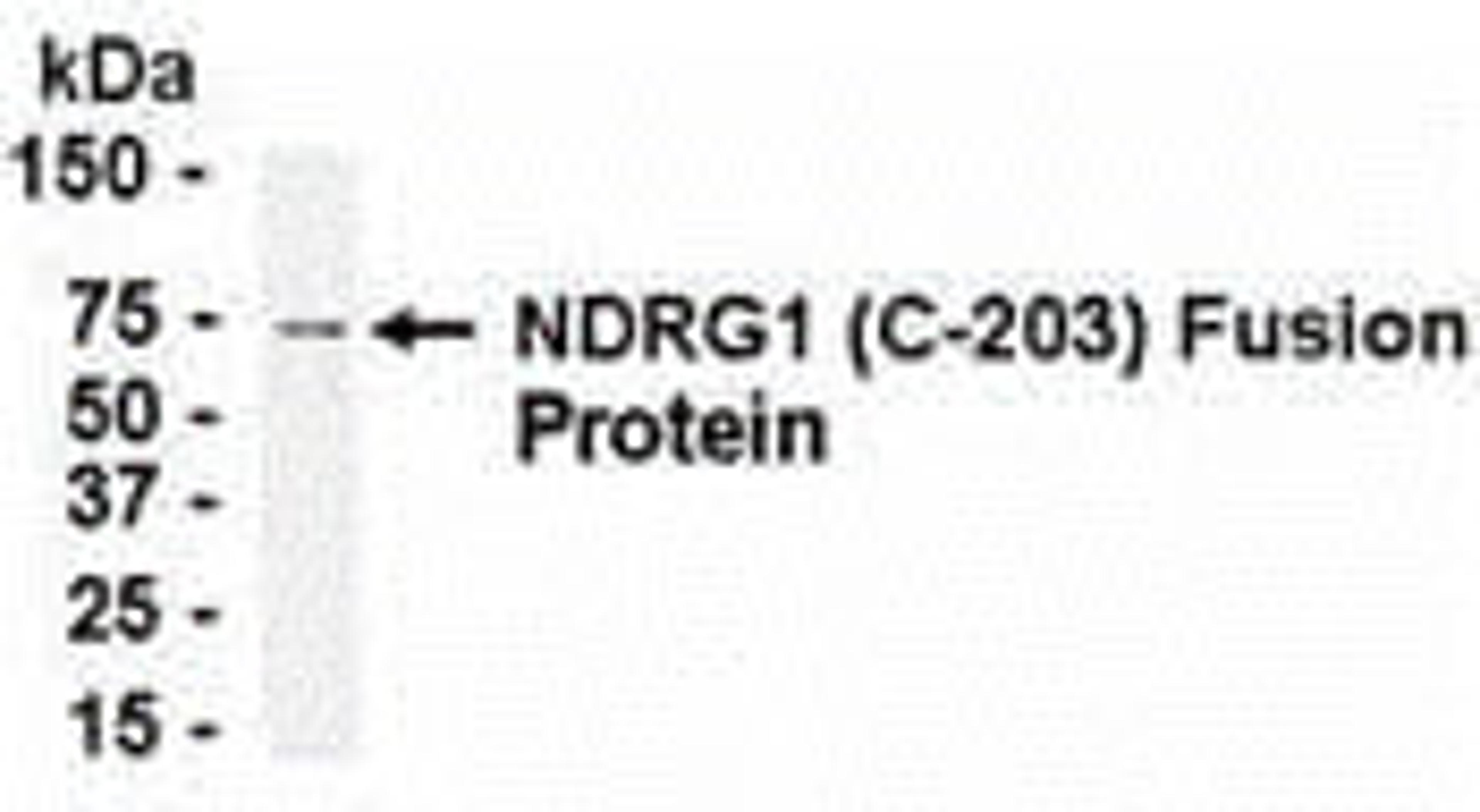 E coli-derived fusion protein as test antigen. Affinity-purified IgY dilution: 1:2000, Goat anti-IgY-HRP dilution: 1:1000. Colorimetric method for signal development.