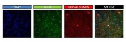 Immunohistochemistry-Frozen: Connexin 36/GJD2 Antibody [NBP1-59254] - IHC detection of Connexin 36/GJA9 in 50uM thick section of Mouse Brain. The tissues were pre-fixed overnight in 4% PFA, and primary antibody NBP1-59254 was used at a concentration of 1ug/mL (along with Parvalbumin antibody for double staining) with gentle shaking and overnight incubation at 4C. For the detection of NBP1-59254 primary, anti-rabbit Alexa 555 secondary was employed and images were captured using a confocal microscope at 63X resolution.