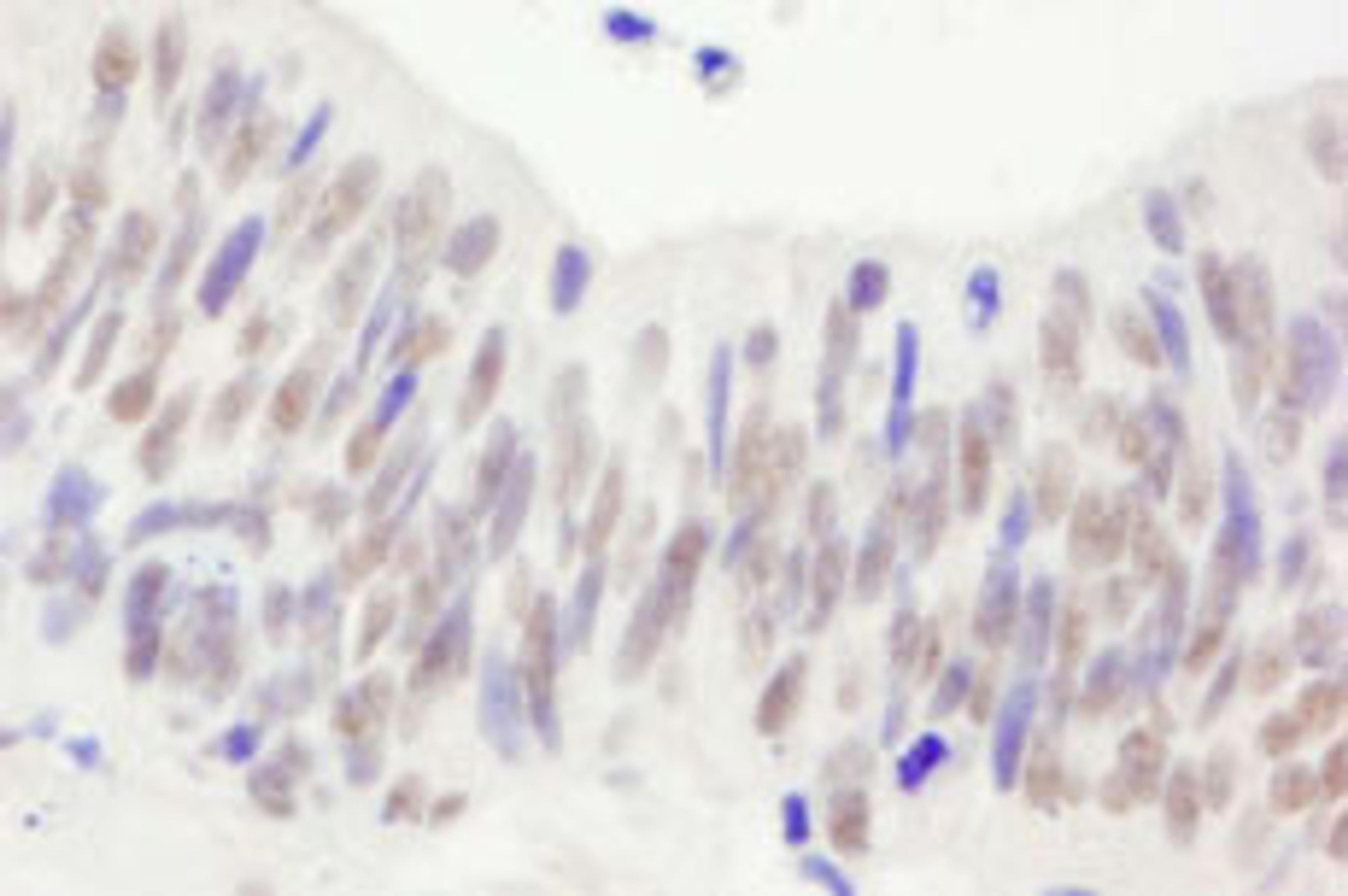 Detection of human NBS1 by immunohistochemistry.