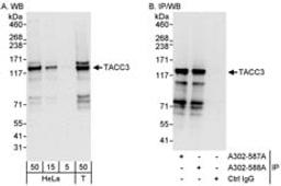 Detection of human TACC3 by western blot and immunoprecipitation.