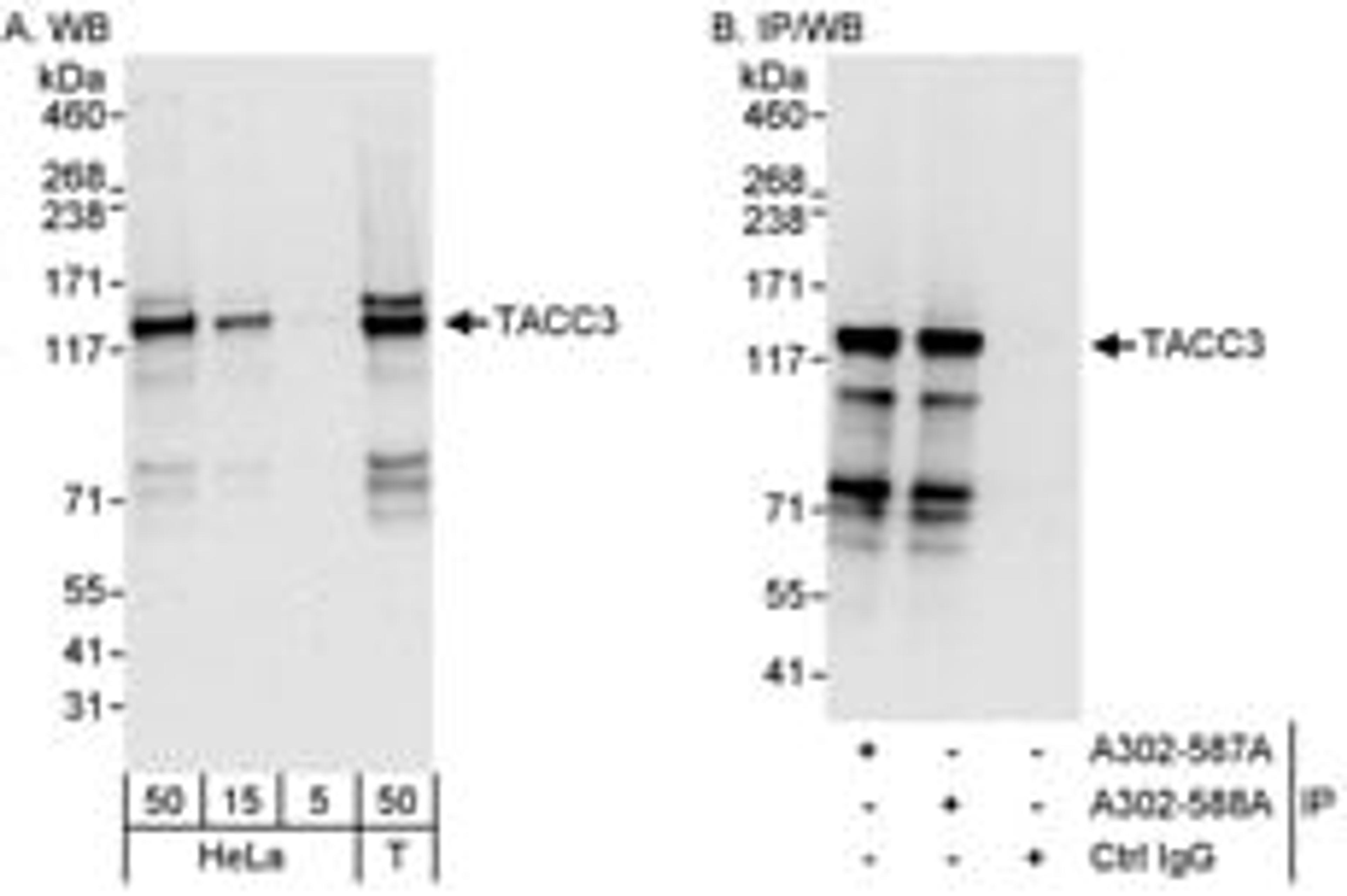 Detection of human TACC3 by western blot and immunoprecipitation.