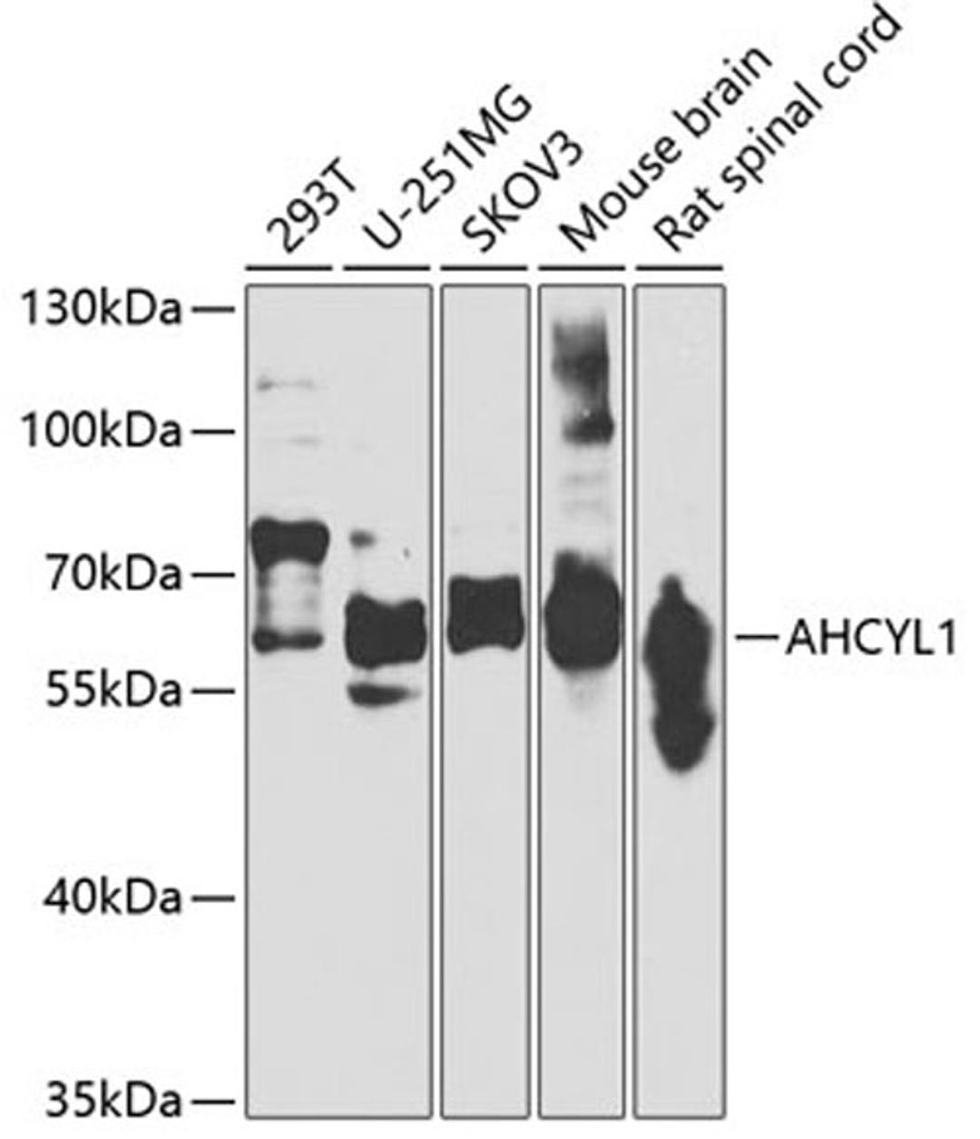 Western blot - AHCYL1 antibody (A7773)