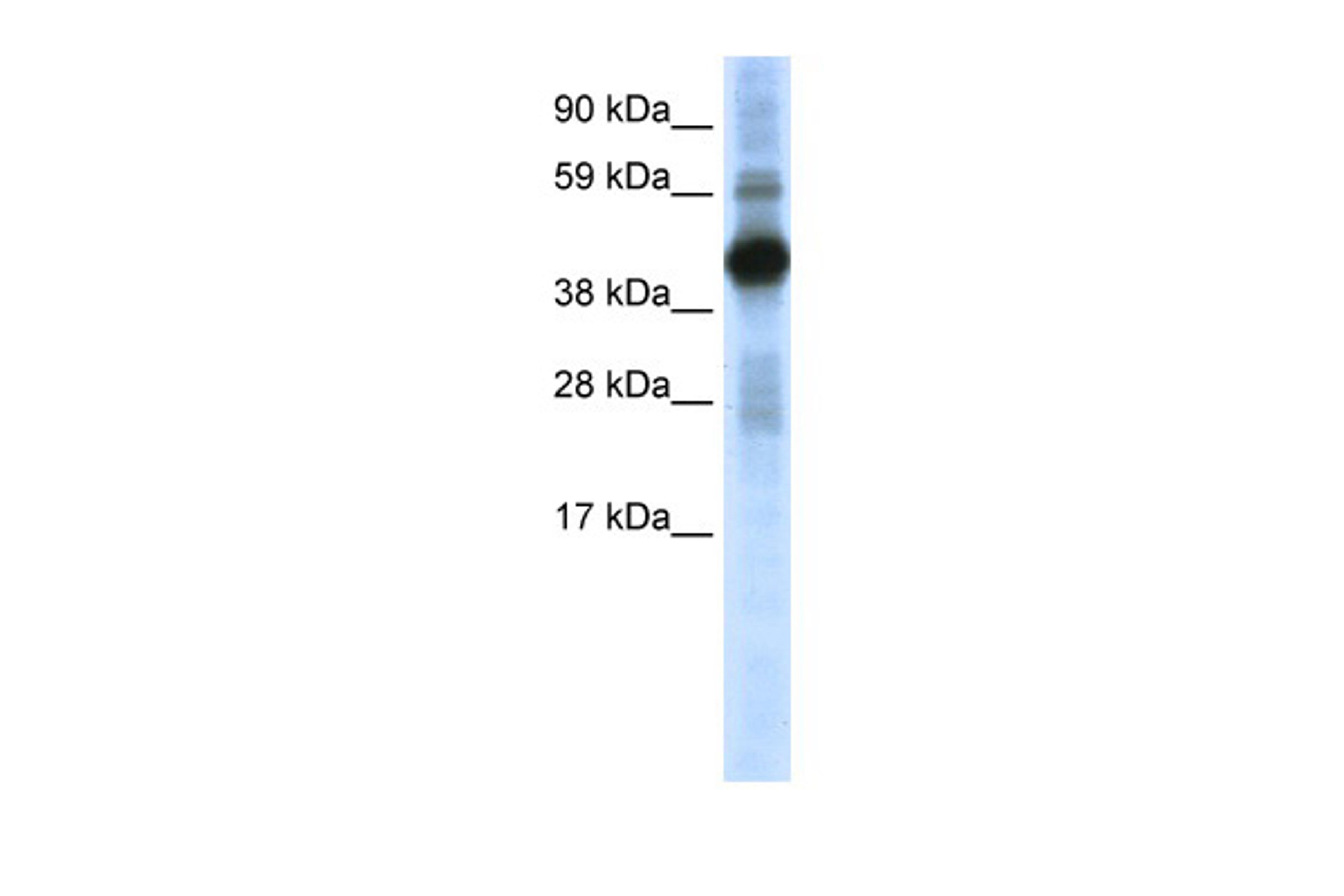 Antibody used in WB on Mouse SP2/0 at 0.2-1 ug/ml.