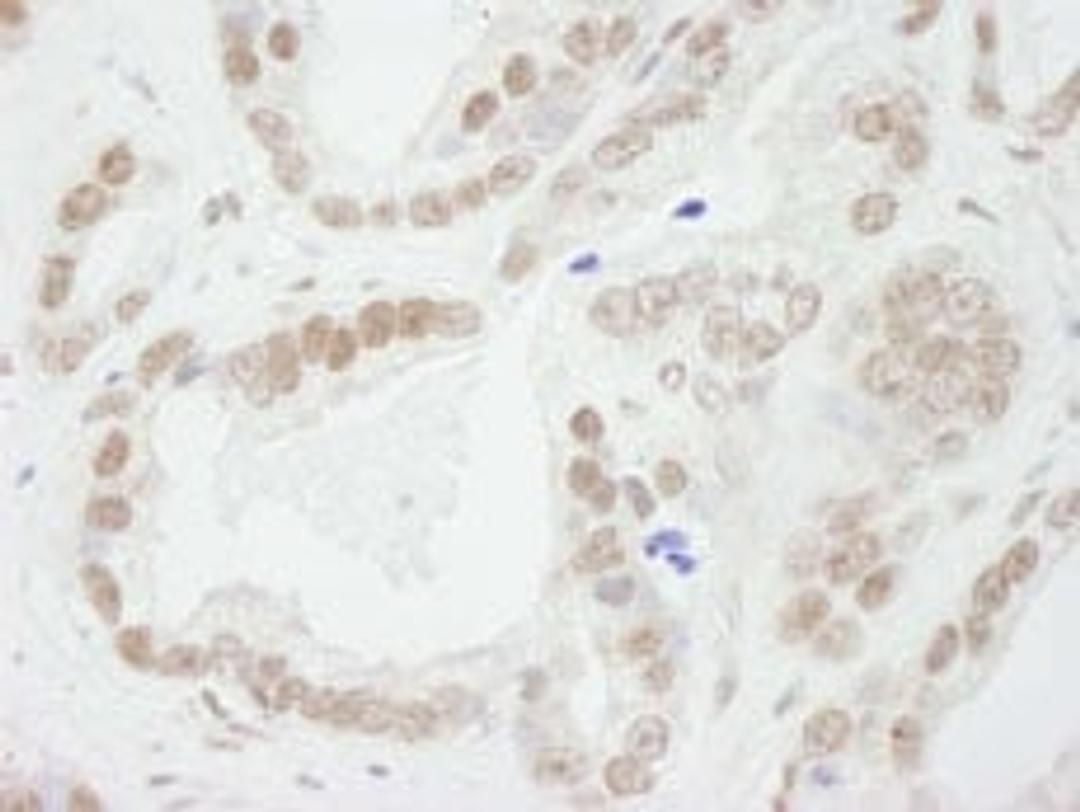 Detection of human BUB3 by immunohistochemistry.