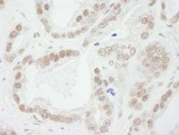 Detection of human BUB3 by immunohistochemistry.