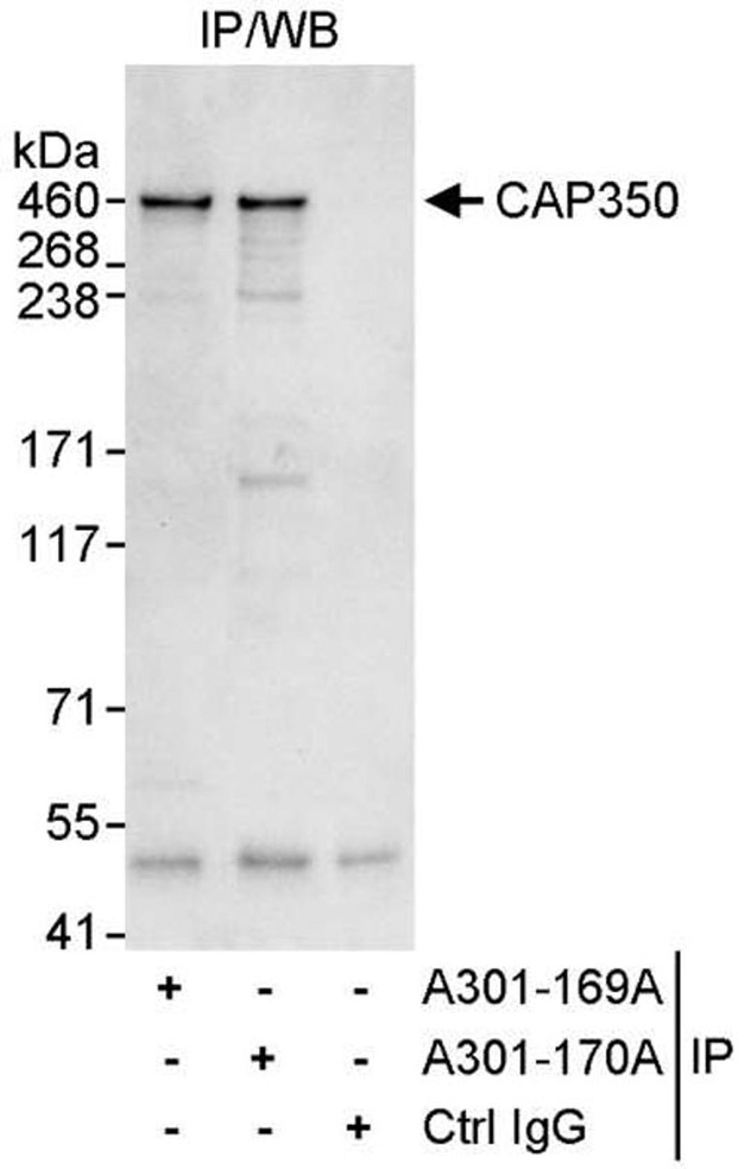 Detection of human CAP350 by WB of IP.