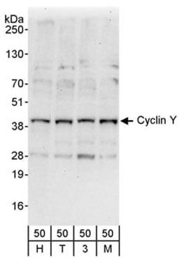 Detection of human Cyclin Y by western blot.