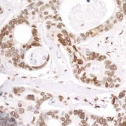 Detection of human Phospho RNA Polymerase II (S5) by immunohistochemistry.