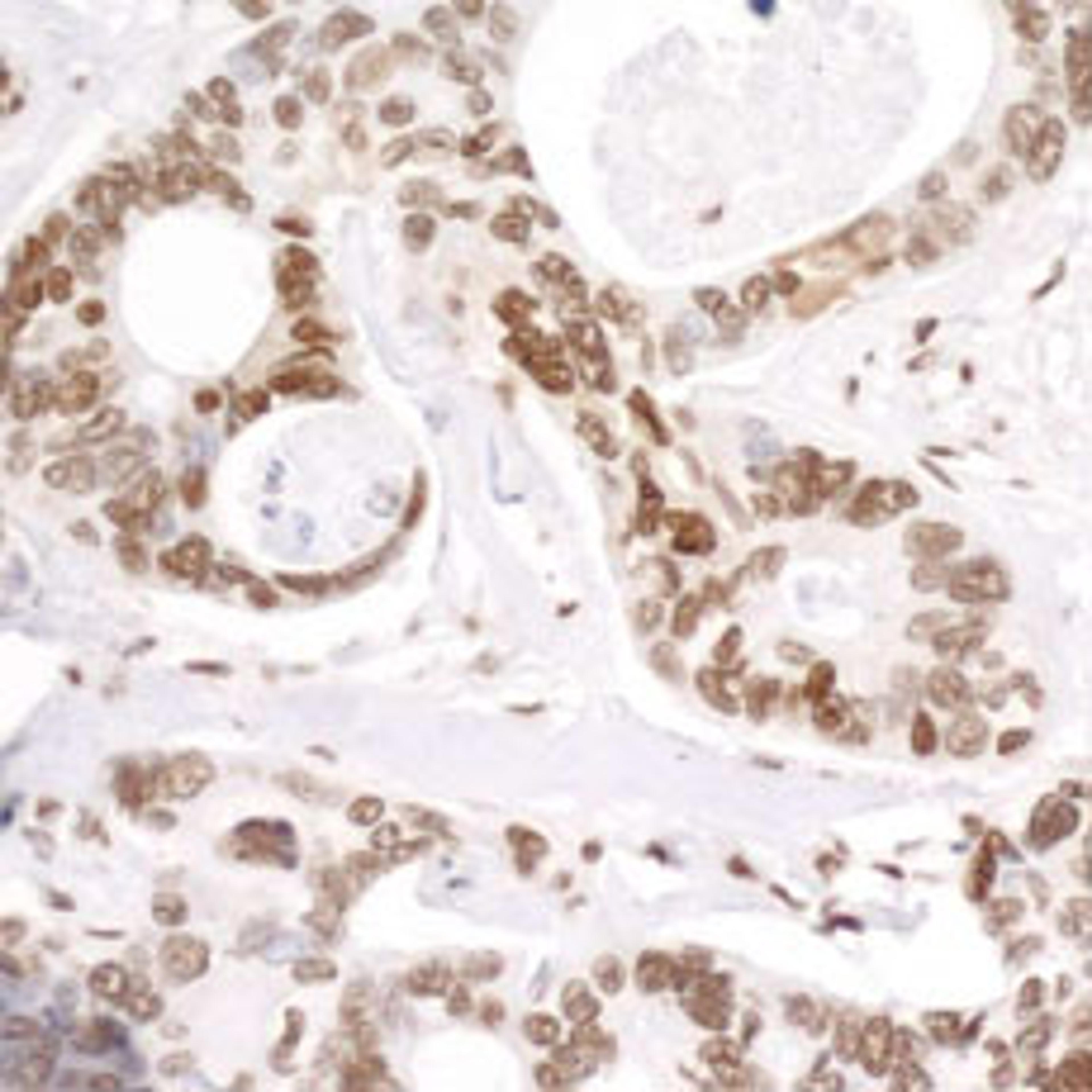 Detection of human Phospho RNA Polymerase II (S5) by immunohistochemistry.