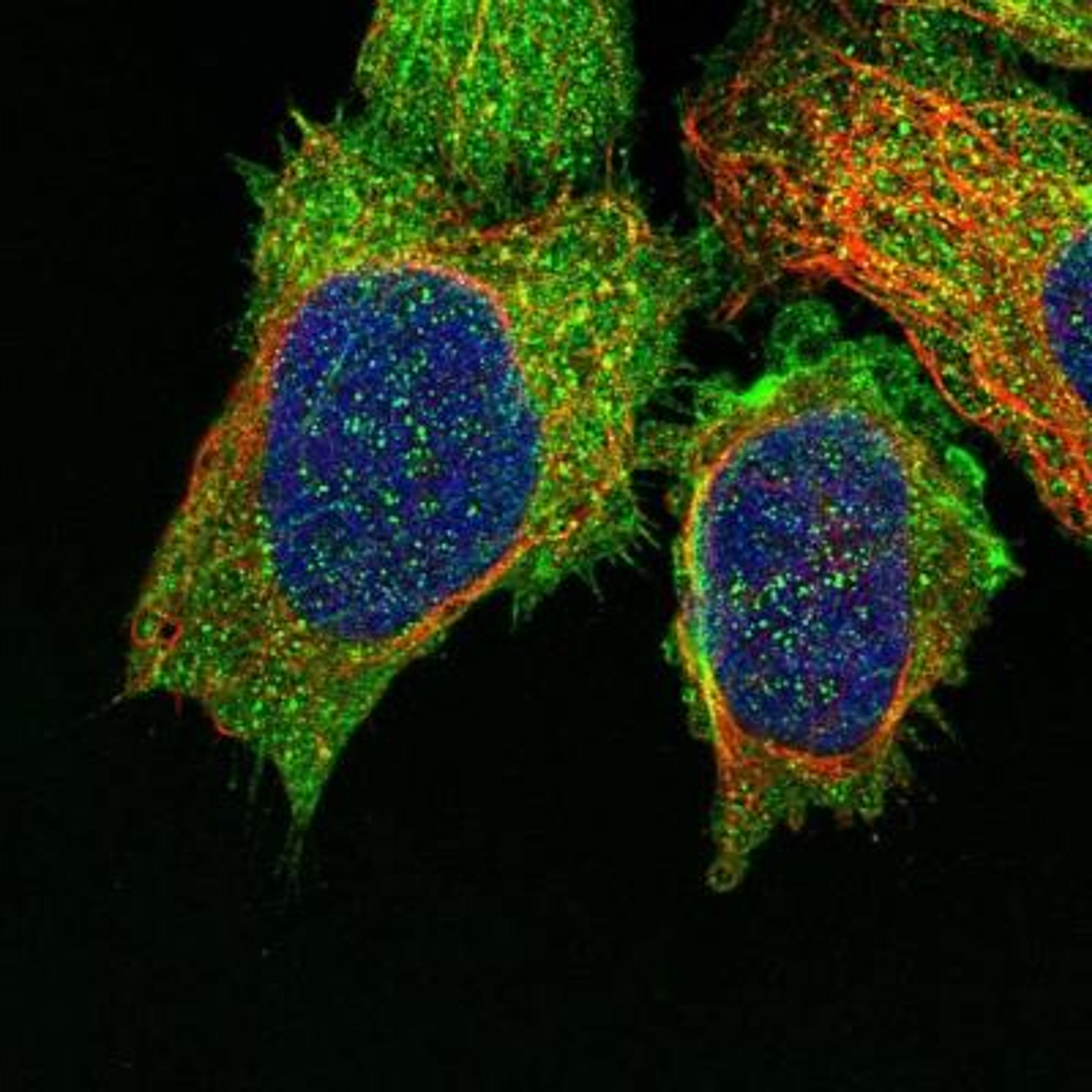 Immunocytochemistry/Immunofluorescence: C9orf72 Antibody [NBP1-93504] - Staining of human cell line U-2 OS shows positivity in plasma membrane & cytoskeleton (actin filaments).