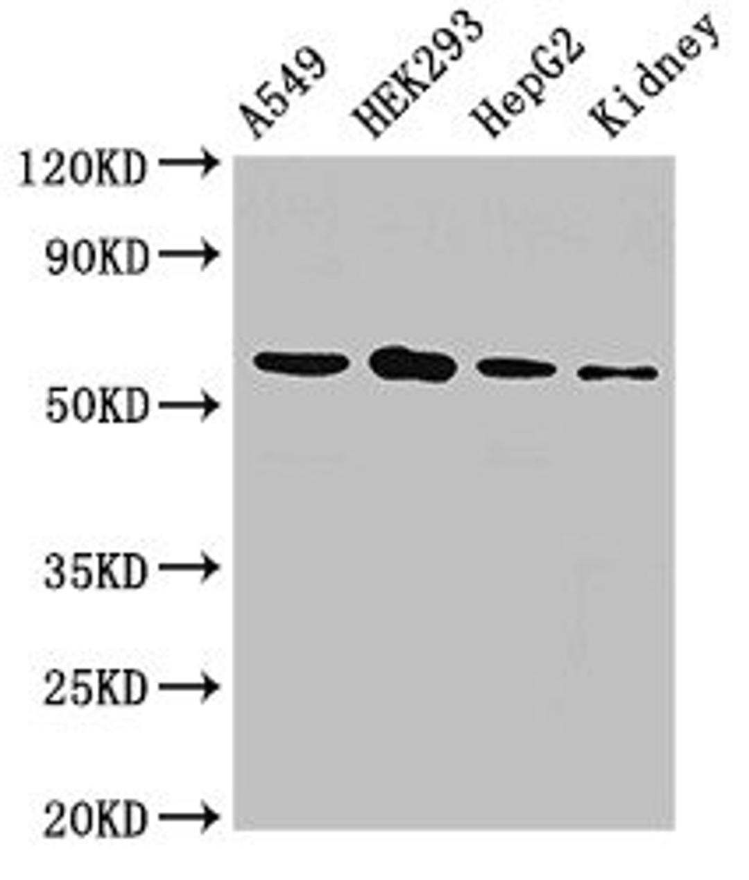 Western Blot. Positive WB detected in: A549 whole cell lysate, HEK293 whole cell lysate, HepG2 whole cell lysate, Rat kidney tissue. All lanes: P4HA1 antibody at 2.5ug/ml. Secondary. Goat polyclonal to rabbit IgG at 1/50000 dilution. Predicted band size: 62, 61, 59 kDa. Observed band size: 62 kDa.