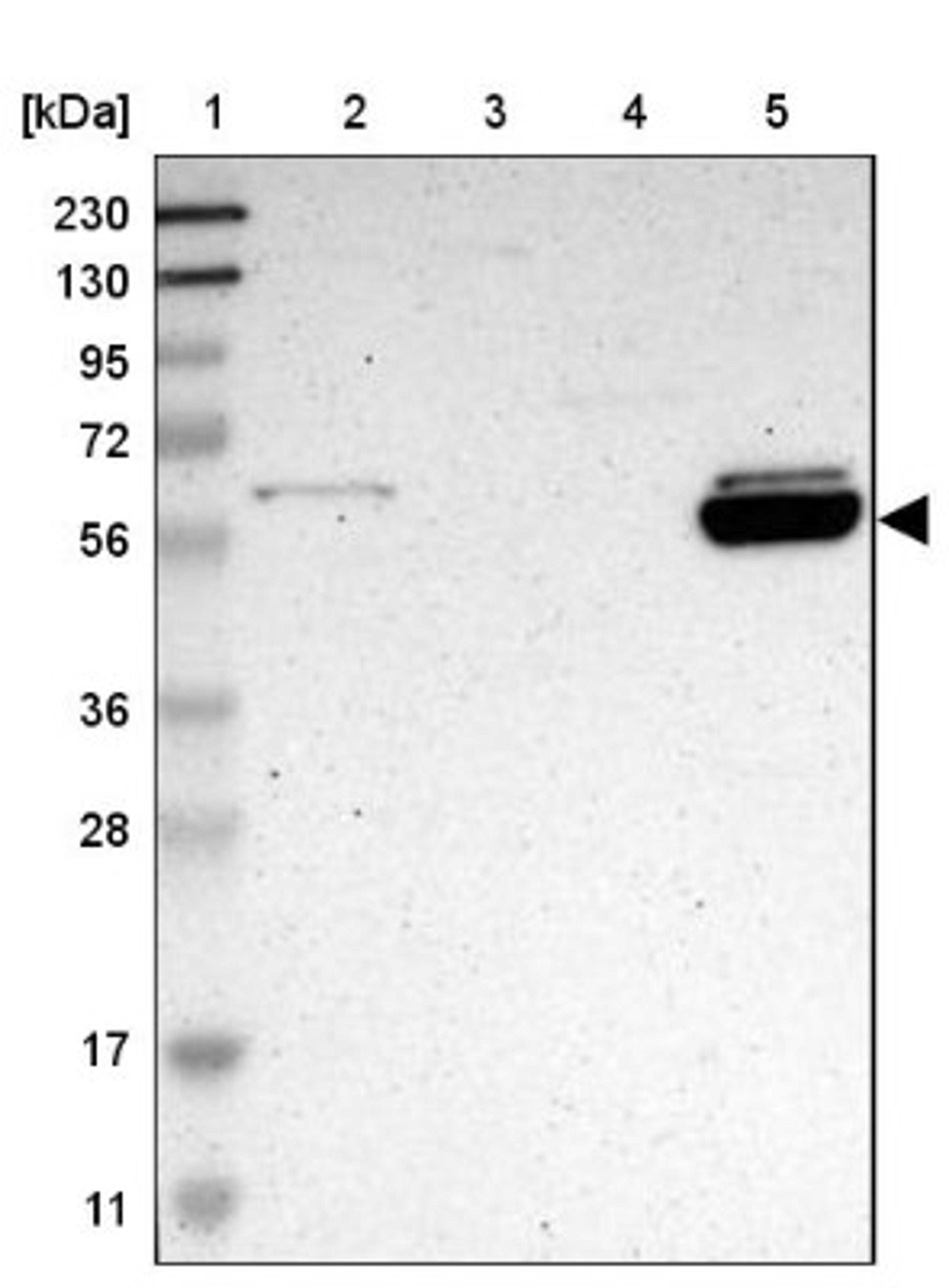 Western Blot: ALDH1A2 Antibody [NBP1-87158] - Lane 1: Marker [kDa] 230, 130, 95, 72, 56, 36, 28, 17, 11<br/>Lane 2: Human cell line RT-4<br/>Lane 3: Human cell line U-251MG sp<br/>Lane 4: Human plasma (IgG/HSA depleted)<br/>Lane 5: Human liver tissue