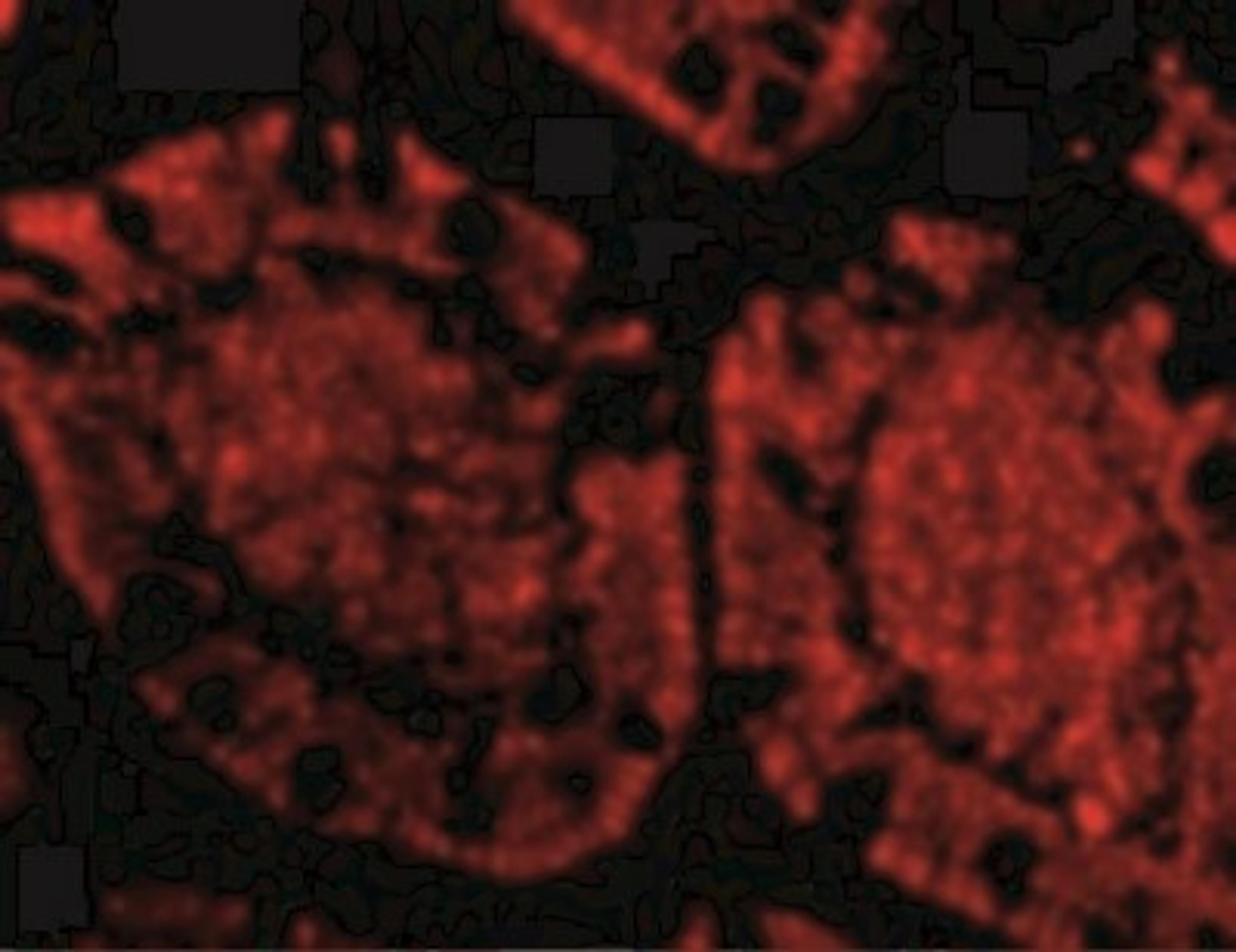 Immunocytochemistry/Immunofluorescence: ZBP1/DLM-1/DAI Antibody [NBP1-76854] - Immunofluorescence of ZBP1 in Human Small Intestine tissue with ZBP1 antibody at 20 ug/mL.