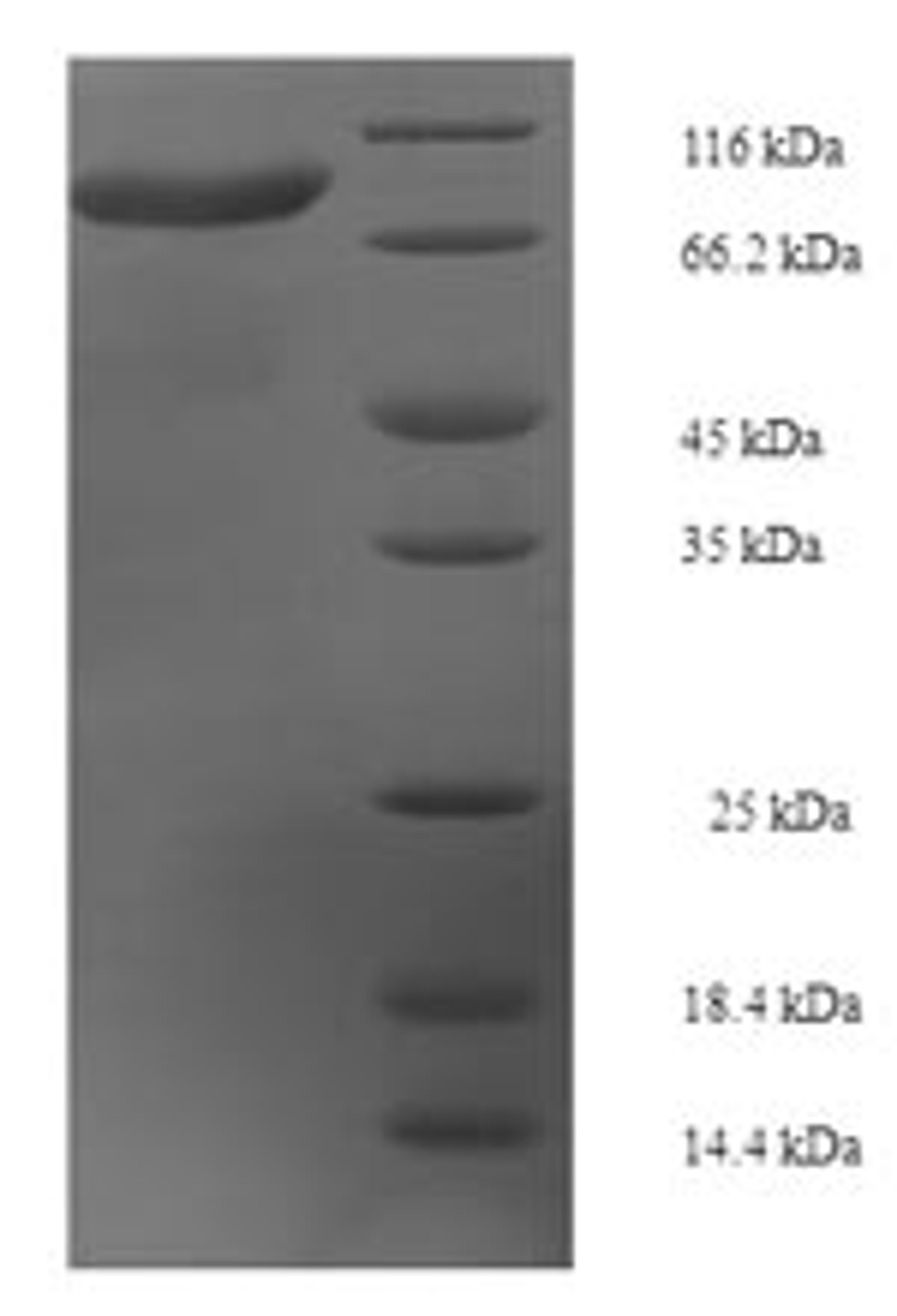 (Tris-Glycine gel) Discontinuous SDS-PAGE (reduced) with 5% enrichment gel and 15% separation gel.