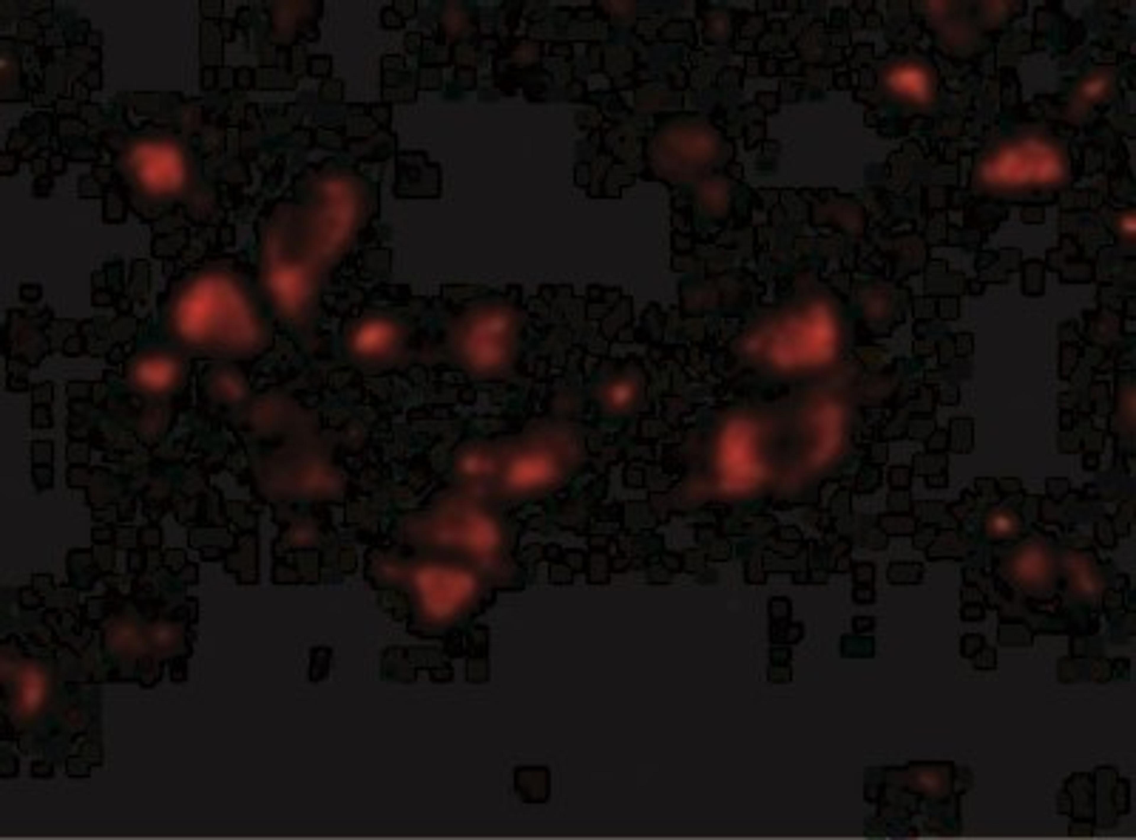 Immunocytochemistry/Immunofluorescence: JPH4 Antibody [NBP2-41094] - Immunofluorescence of JPH4 in Human Brain cells with JPH4 antibody at 20 ug/mL.