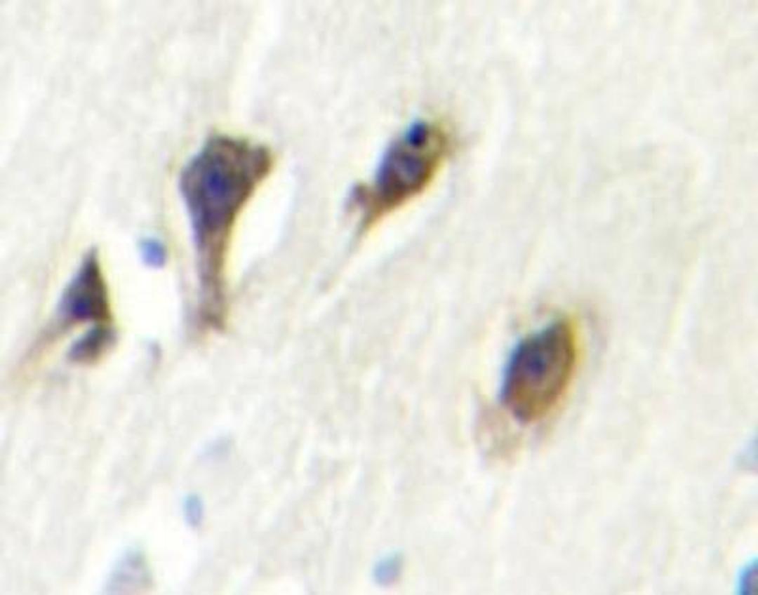 Immunohistochemistry-Paraffin: JNK3 Antibody [NBP1-19542] - Immunohistochemistry (IHC) analyzes of JNK3 (K391) pAb in paraffin-embedded human brain tissue.