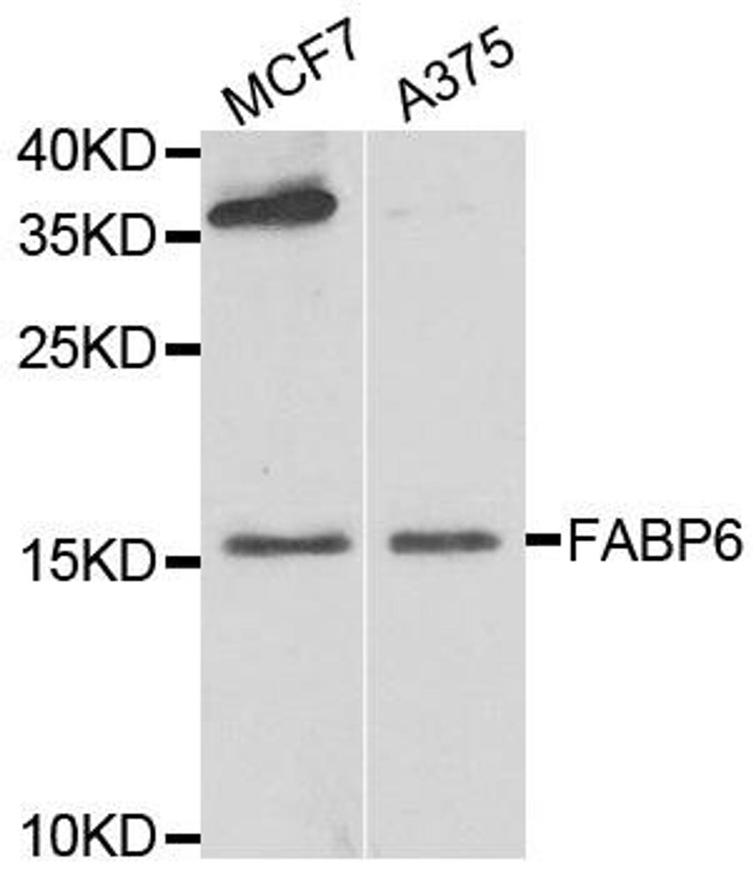 Western blot analysis of extracts of various cell lines using FABP6 antibody