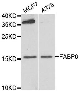 Western blot analysis of extracts of various cell lines using FABP6 antibody