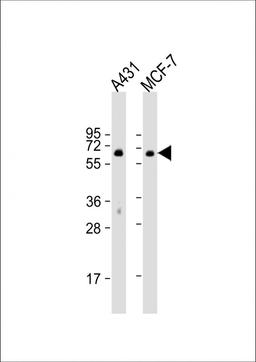 Western Blot at 1:1000 dilution Lane 1: A431 whole cell lysate Lane 2: MCF-7 whole cell lysate Lysates/proteins at 20 ug per lane.