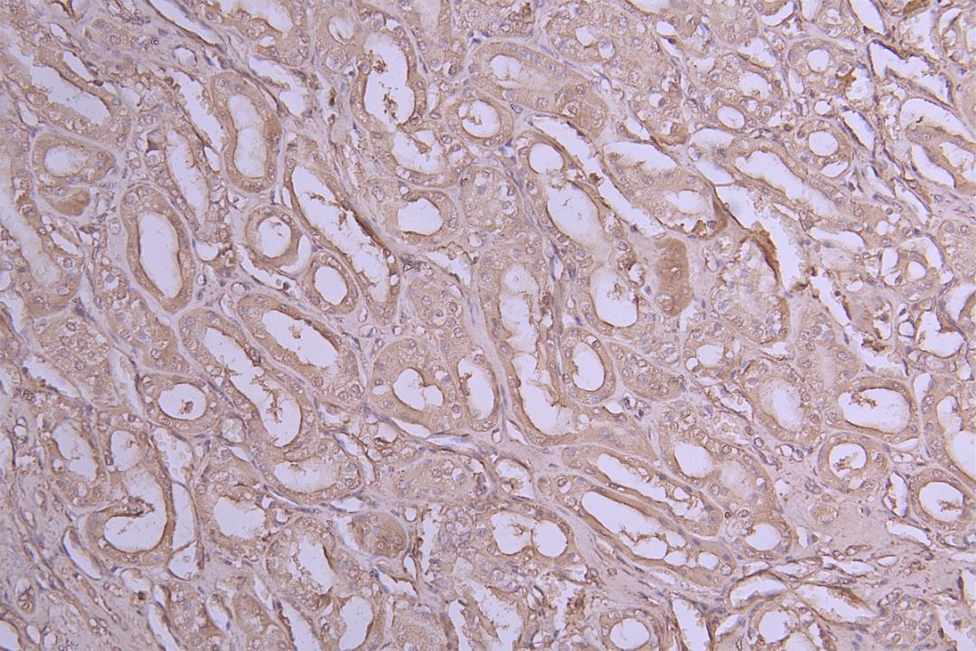 IHC image of CSB-RA011614MA1HU diluted at 1:100 and staining in paraffin-embedded human kidney tissue performed on a Leica BondTM system. After dewaxing and hydration, antigen retrieval was mediated by high pressure in a citrate buffer (pH 6.0). Section was blocked with 10% normal goat serum 30min at RT. Then primary antibody (1% BSA) was incubated at 4°C overnight. The primary is detected by a Goat anti-Human IgG labeled by HRP and visualized using 0.05% DAB.