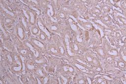 IHC image of CSB-RA011614MA1HU diluted at 1:100 and staining in paraffin-embedded human kidney tissue performed on a Leica BondTM system. After dewaxing and hydration, antigen retrieval was mediated by high pressure in a citrate buffer (pH 6.0). Section was blocked with 10% normal goat serum 30min at RT. Then primary antibody (1% BSA) was incubated at 4°C overnight. The primary is detected by a Goat anti-Human IgG labeled by HRP and visualized using 0.05% DAB.