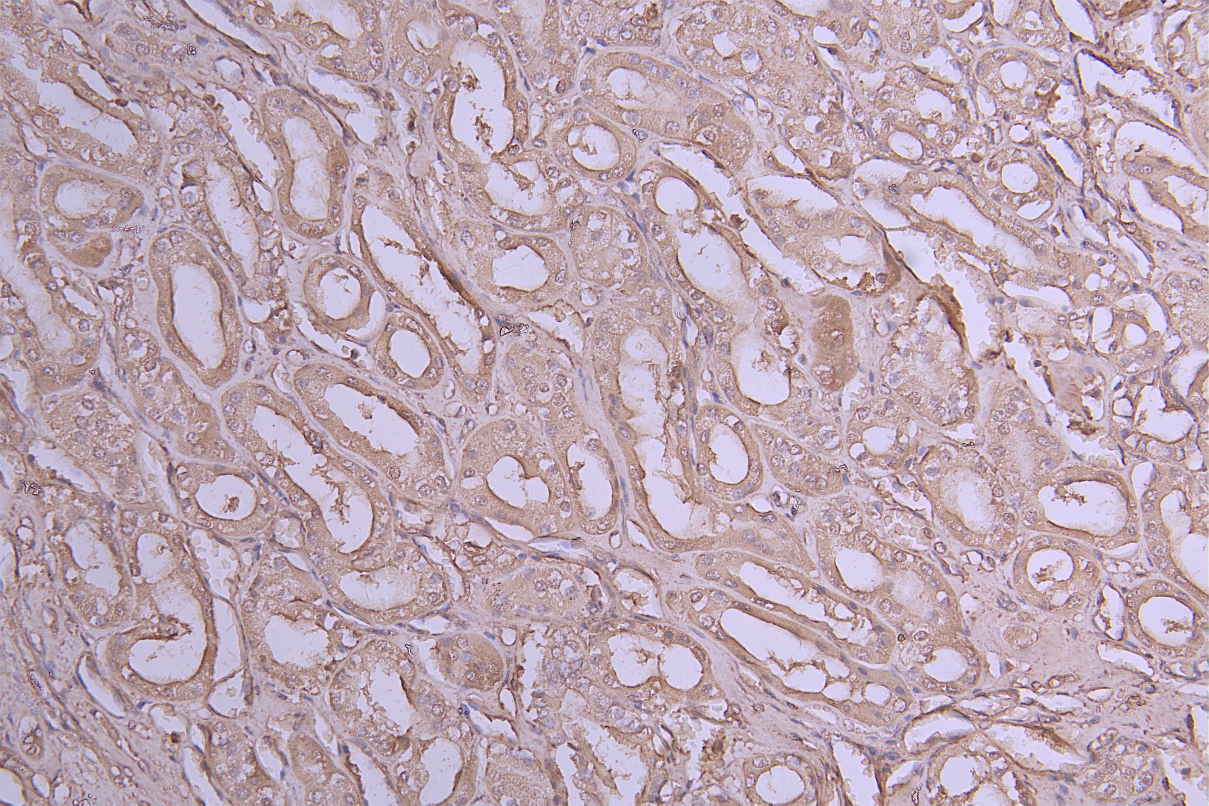 IHC image of CSB-RA011614MA1HU diluted at 1:100 and staining in paraffin-embedded human kidney tissue performed on a Leica BondTM system. After dewaxing and hydration, antigen retrieval was mediated by high pressure in a citrate buffer (pH 6.0). Section was blocked with 10% normal goat serum 30min at RT. Then primary antibody (1% BSA) was incubated at 4°C overnight. The primary is detected by a Goat anti-Human IgG labeled by HRP and visualized using 0.05% DAB.