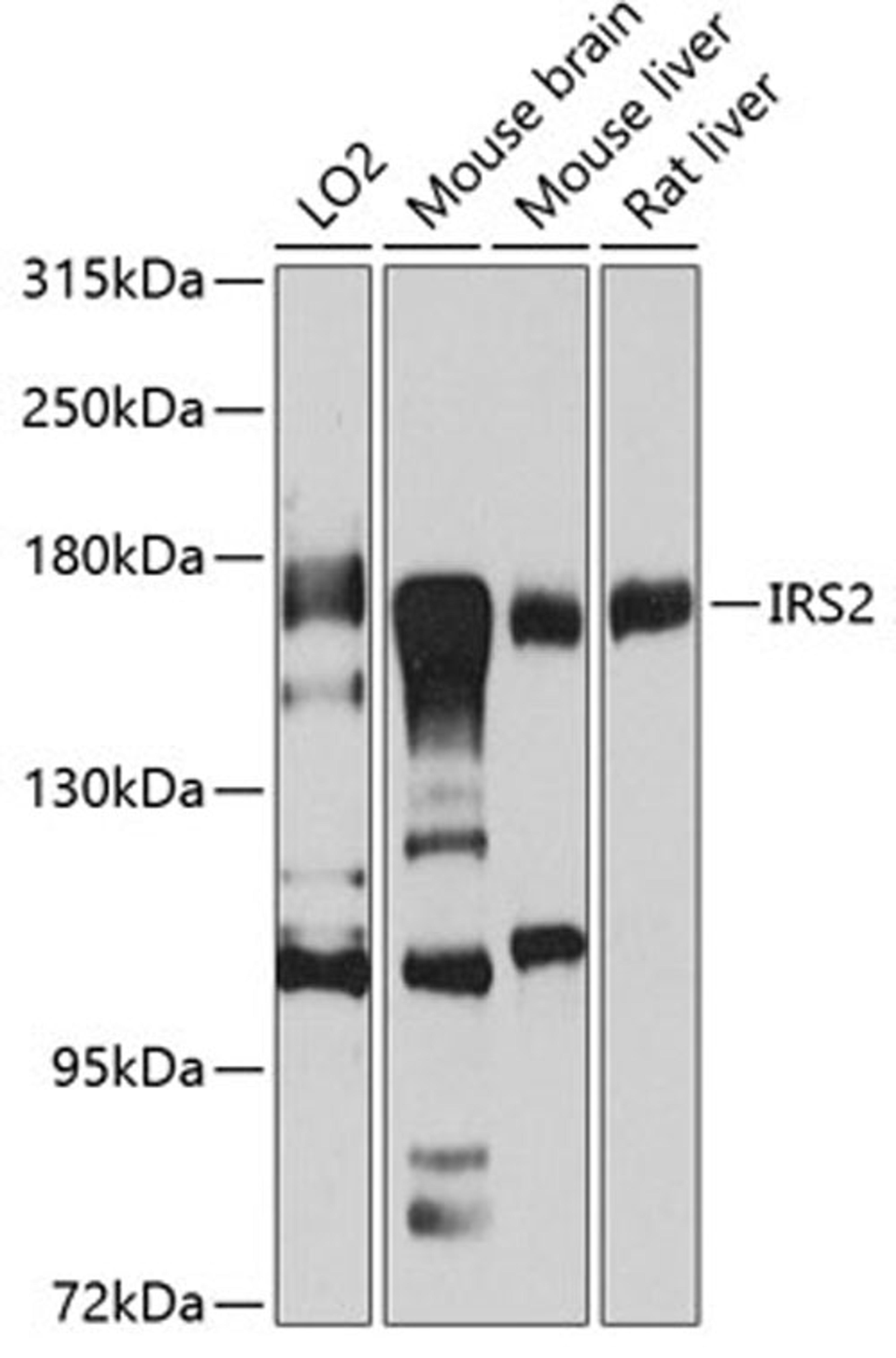 Western blot - IRS2 antibody (A7945)